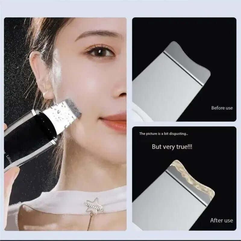 Blackhead Remover Blackhead Cleaning Pore Shrinking Beauty Device Dead Skin Acne Scalper Facial Pore Cleanser