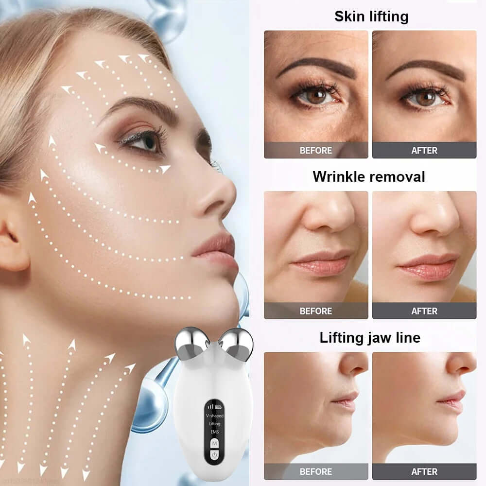 Face Lifting Massager EMS Microcurrent EMS Facial Massager Face Wrinkle Lift Machine anti Wrinkle Chin-Up Face Lifting Massager