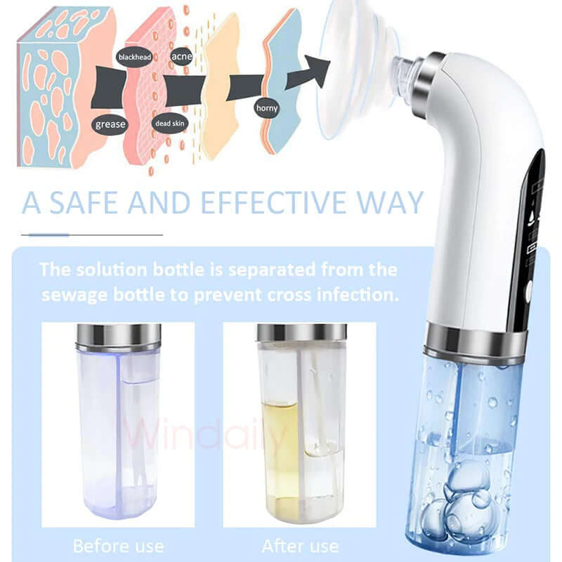 2024 Blackhead Remover Pore Vacuum Cleaner Electric Micro Small Bubble Facial Cleasing Machine USB Rechargeable Beauty Device